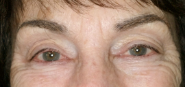 Millie after soft fill brow