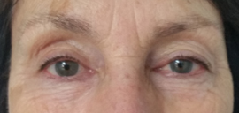 Millie before soft fill brow