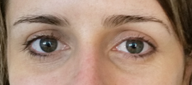flower before solid fill brow & enhanced arch