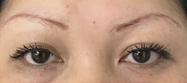 pegasu before brow reshape and color correction